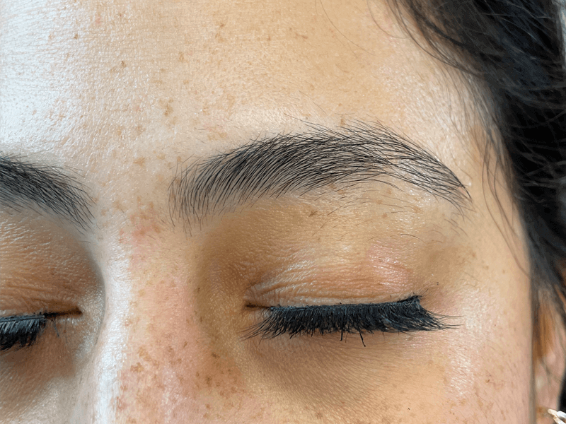 Before brow shaping and hybrid